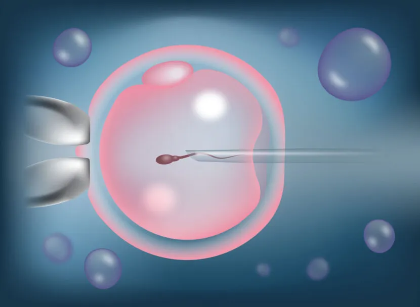 Advanced Fertility Solution for Male Infertility 