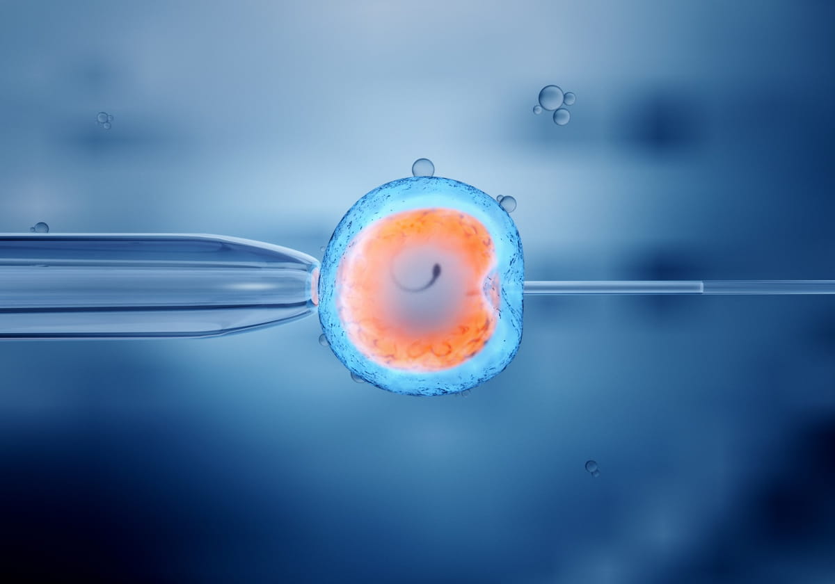 Advanced IVF Treatment in Uttam Nagar, Delhi