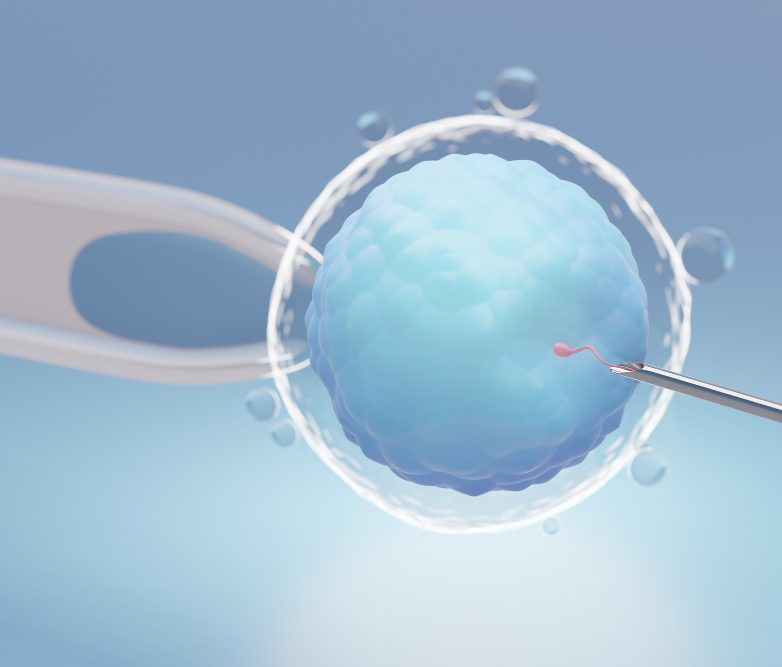 Advanced Laser Assisted Hatching Treatment in Uttam Nagar