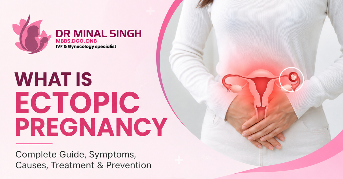 What is Ectopic Pregnancy – Complete Guide
